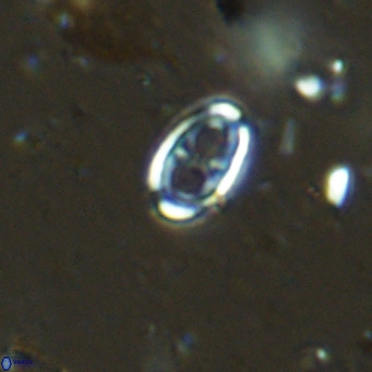 Amphyzygus megalops VR 14886