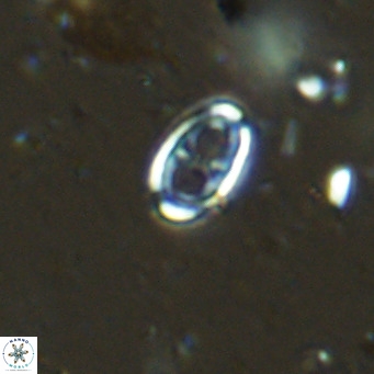 Amphyzygus megalops VR 14886