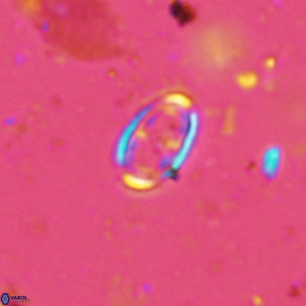 Amphyzygus megalops VR 14887
