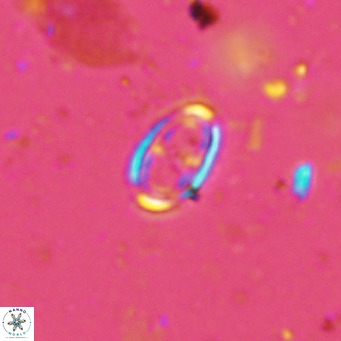 Amphyzygus megalops VR 14887