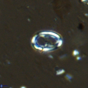 Amphyzygus megalops VR 14888
