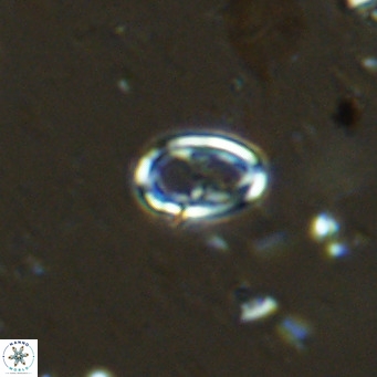 Amphyzygus megalops VR 14888