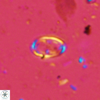 Amphyzygus megalops VR 14889