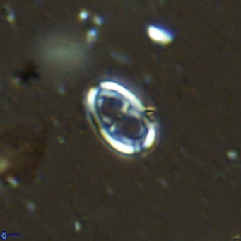Amphyzygus megalops VR 14882