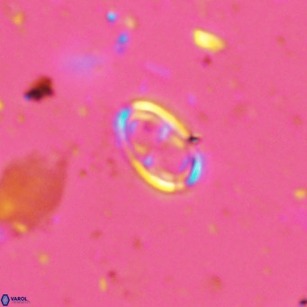 Amphyzygus megalops VR 14883