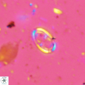 Amphyzygus megalops VR 14883