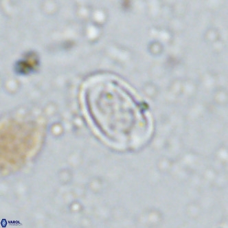 Amphyzygus megalops VR 14894