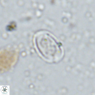Amphyzygus megalops VR 14894