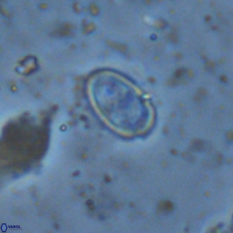 Amphyzygus megalops VR 14895