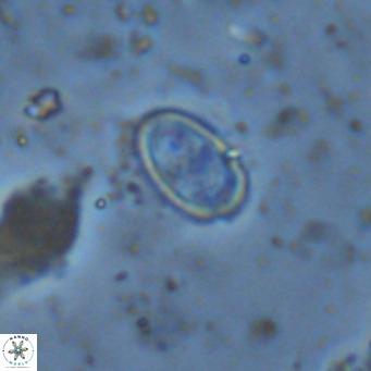 Amphyzygus megalops VR 14895