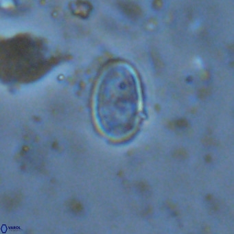 Amphyzygus megalops VR 14896