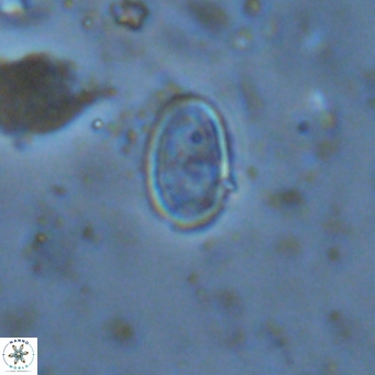 Amphyzygus megalops VR 14896