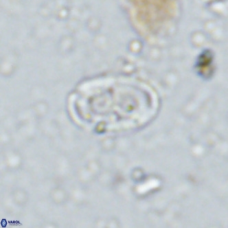 Amphyzygus megalops VR 14890