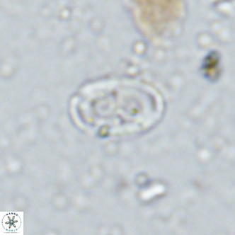 Amphyzygus megalops VR 14890