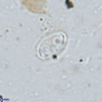 Amphyzygus megalops VR 14891