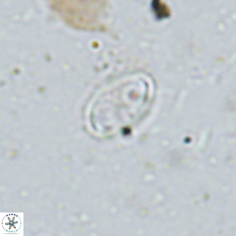 Amphyzygus megalops VR 14891