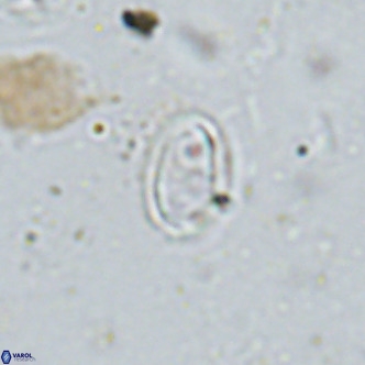Amphyzygus megalops VR 14892