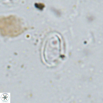 Amphyzygus megalops VR 14892