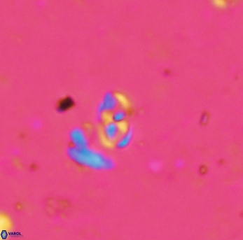 Anfractus harrisonii 1584