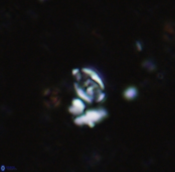 Anfractus harrisonii 1585