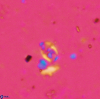 Anfractus harrisonii 1586