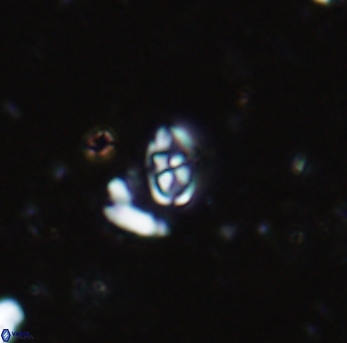 Anfractus harrisonii 1583