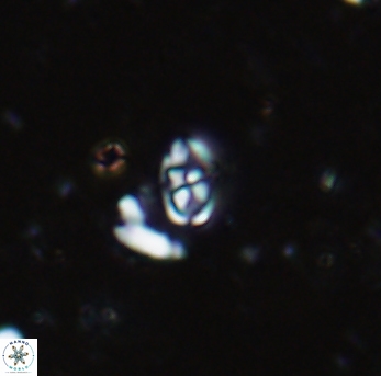 Anfractus harrisonii 1583