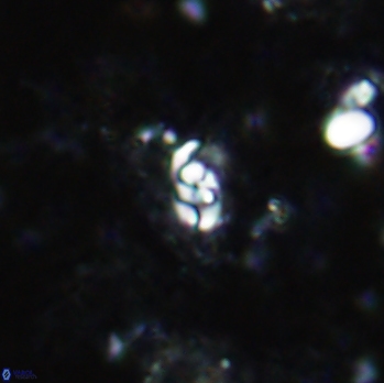 Anfractus harrisonii 1616