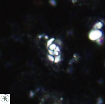 Anfractus harrisonii 1616
