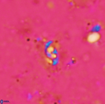 Anfractus harrisonii 1617