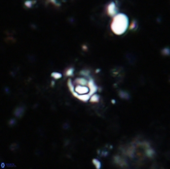 Anfractus harrisonii 1618