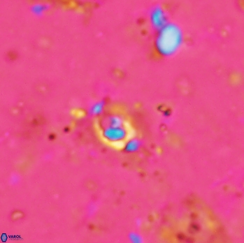 Anfractus harrisonii 1619