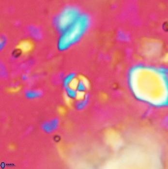 Anfractus harrisonii 2079