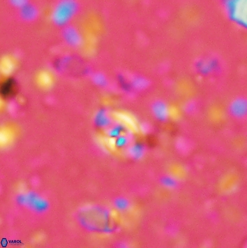 Anfractus harrisonii 2159