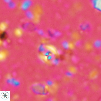 Anfractus harrisonii 2159