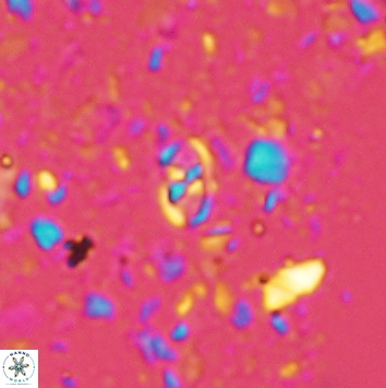 Anfractus harrisonii 2164