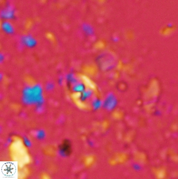 Anfractus harrisonii 2165