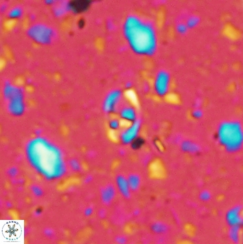Anfractus harrisonii 2160