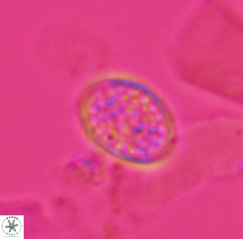 Angulofenestrellithus snyderi 10143