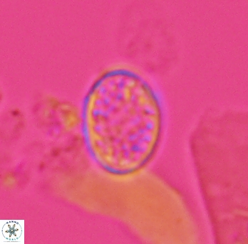 Angulofenestrellithus snyderi 10145