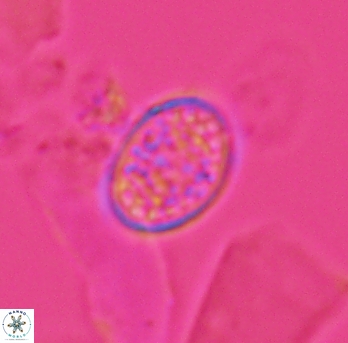 Angulofenestrellithus snyderi 10147