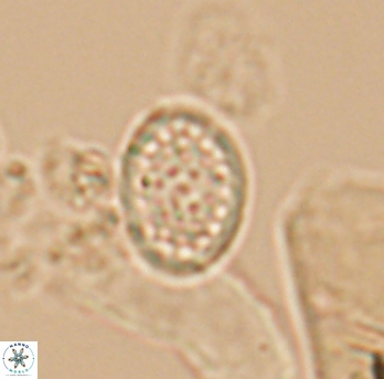 Angulofenestrellithus snyderi 10148