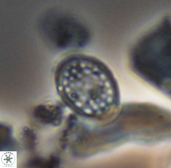 Angulofenestrellithus snyderi 10150
