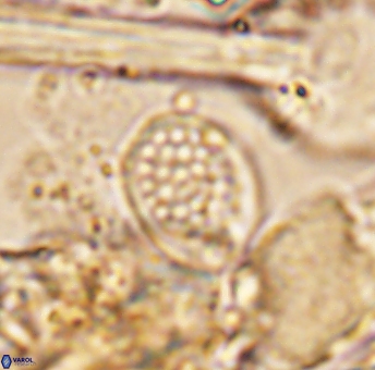 Angulofenestrellithus snyderi 10114