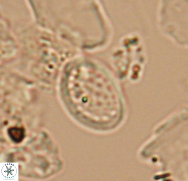 Angulofenestrellithus snyderi 10454