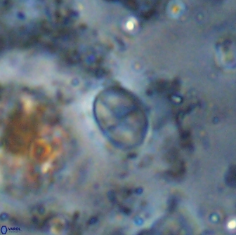 Asapholithos clarusora 15075