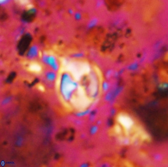 Asapholithos neoanfractus 33597