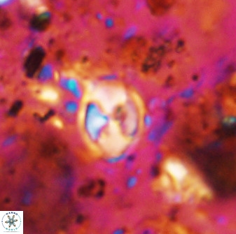 Asapholithos neoanfractus 33597