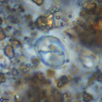 Asapholithos neoanfractus 33604