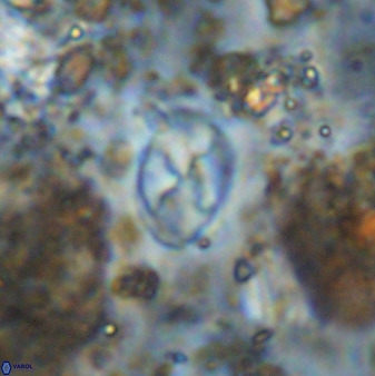 Asapholithos neoanfractus 33605